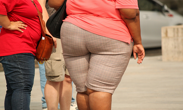 ¿Cuándo una persona es considerarada obesa?