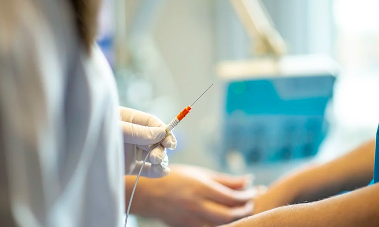 Melanoma el cáncer de piel