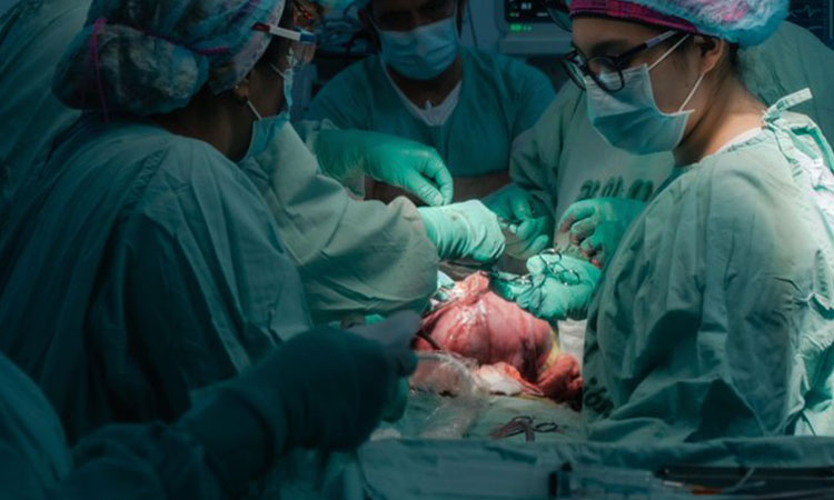 El HUV hace historia en Colombia al realizar una cirugía fetal ‘in útero’