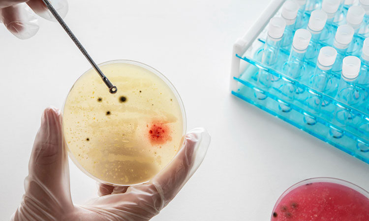 La OMS alerta sobre el preocupante aumento de gonorrea farmacorresistente