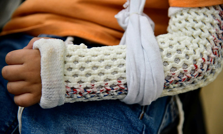 ¿Por que casi la mitad de los niños sufrira una fractura antes de la adolescencia?