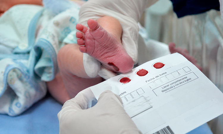 Cada año nacen 8 millones de bebés con anomalías congénitas